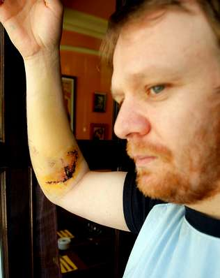 Hombre atacado por varios perros