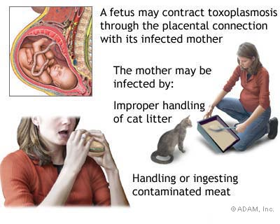 La toxoplasmosis en embarazadas